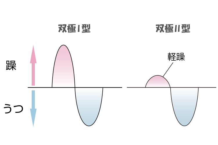 双極I型II型