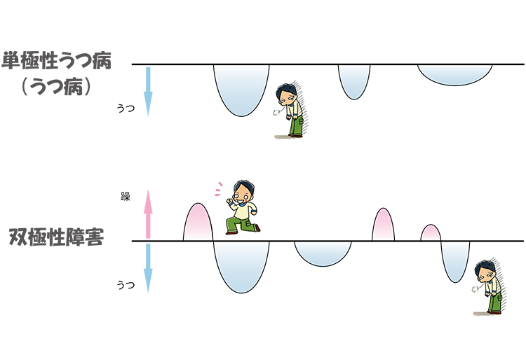 単極性うつ病と双極性障害