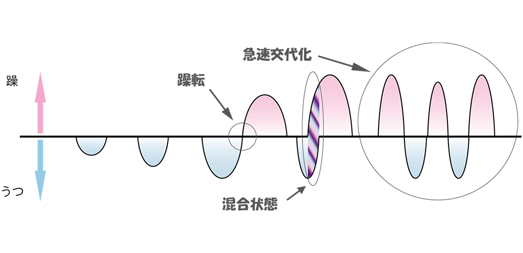 双極性障害とは 原因 症状 治療方法などの解説 すまいるナビゲーター 大塚製薬