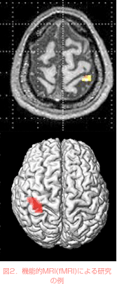 図2．機能的MRI(fMRI)による研究の例