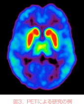 図3．PETによる研究の例