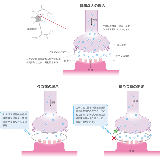 抗 うつ 剤 普通 の 人 が 飲む と