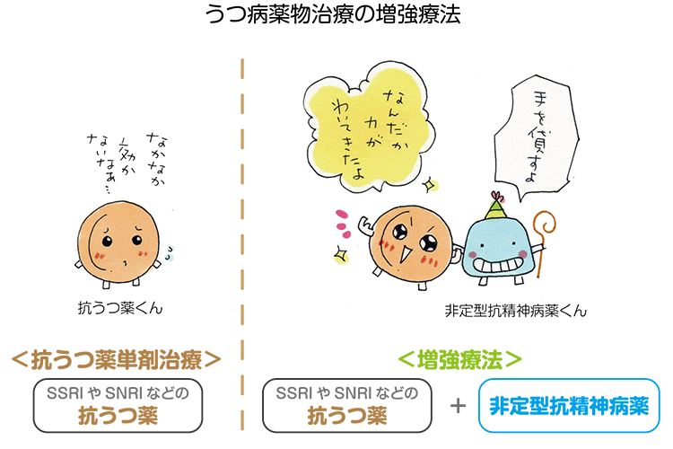 うつ病薬物治療の増強療法